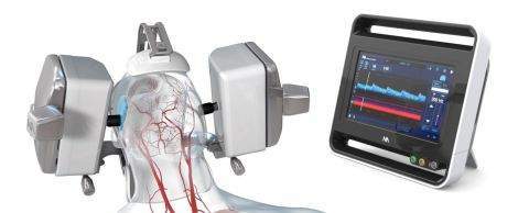 FDA approves Neural Analytics’ robotic ultrasound system