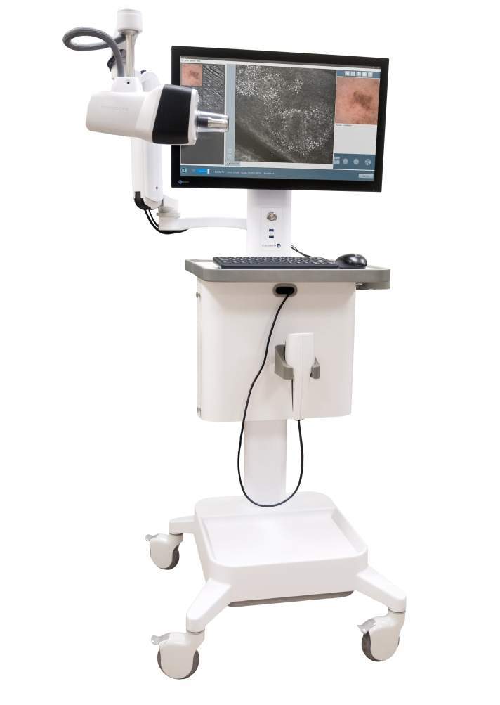 Caliber I.D. launches latest VivaScope 1500 confocal imaging system