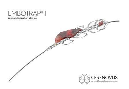 Cerenovus treats first ischemic stroke patients with Embotrap II revascularization device