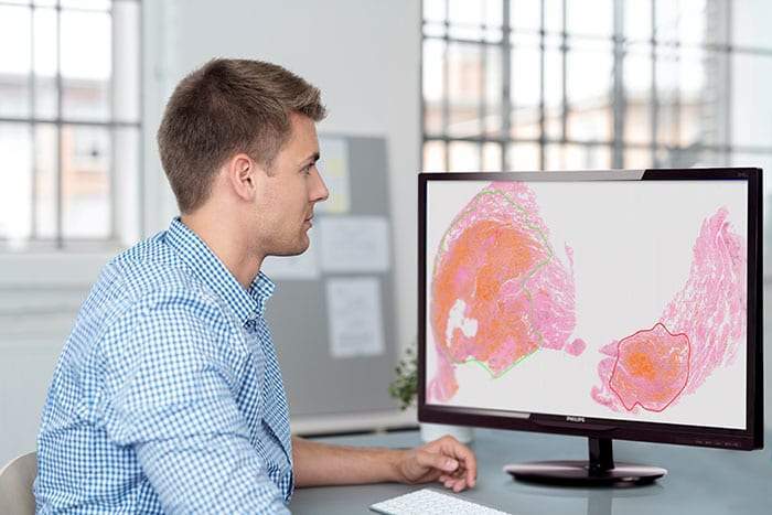 Philips secures MFDS approval for IntelliSite pathology solution in South Korea