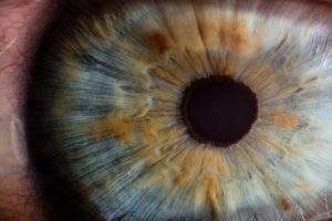 RadianceTx raises initial funding for glaucoma therapy