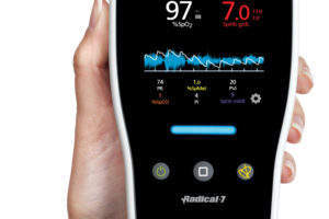 Study investigates use of Masimo’s SET Pulse Oximetry to screen Down Syndrome children
