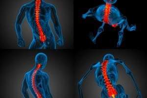 NuVasive, Siemens partner to advance clinical outcomes in minimally invasive spine surgery