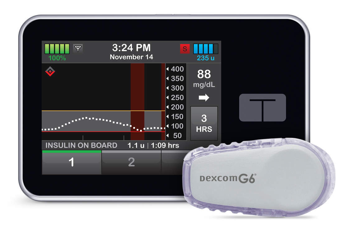 Tandem Diabetes Care introduces t:slim X2 insulin pump with Basal-IQ technology in US