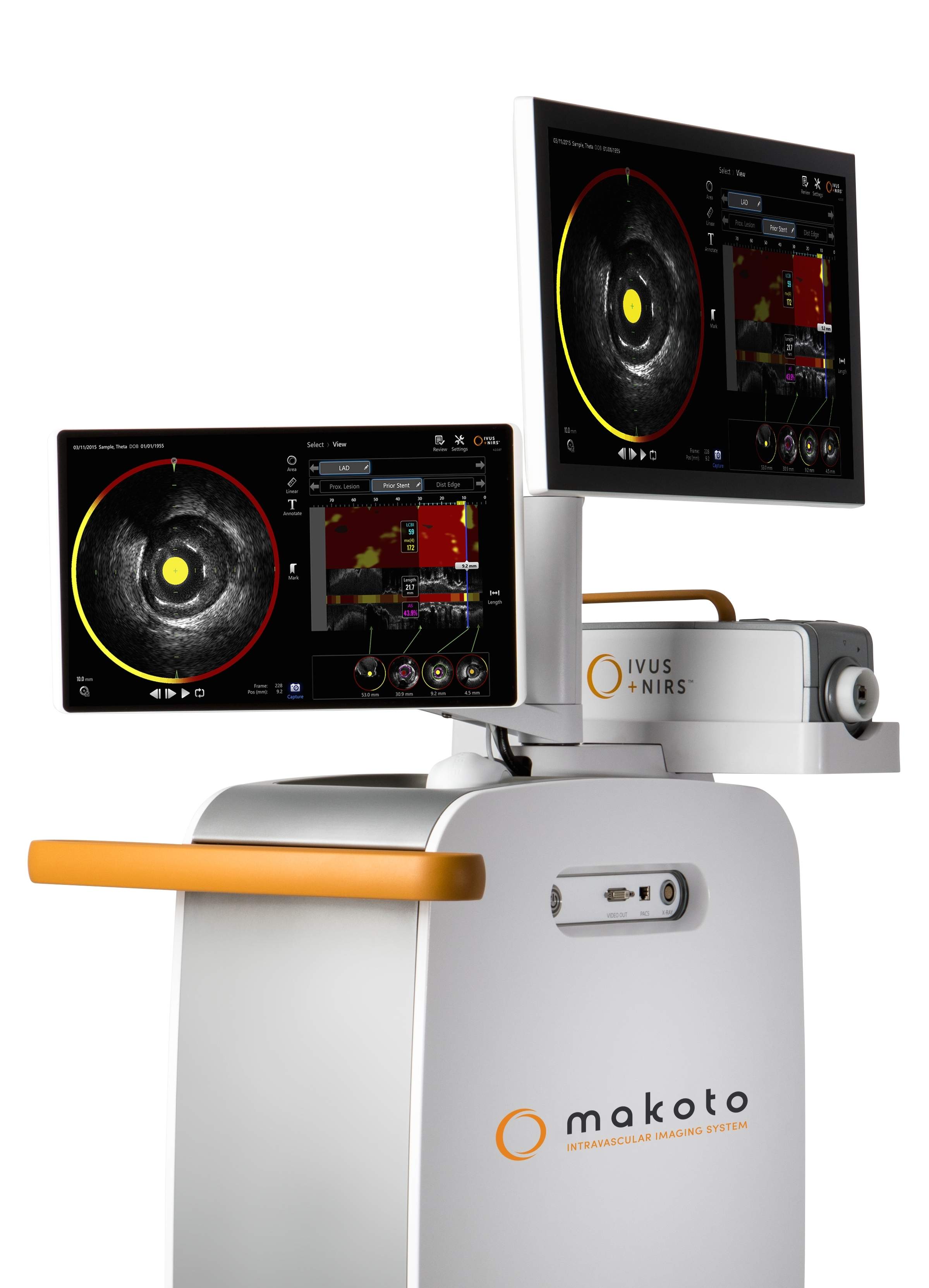 Infraredx launches Makoto intravascular imaging system in Japan
