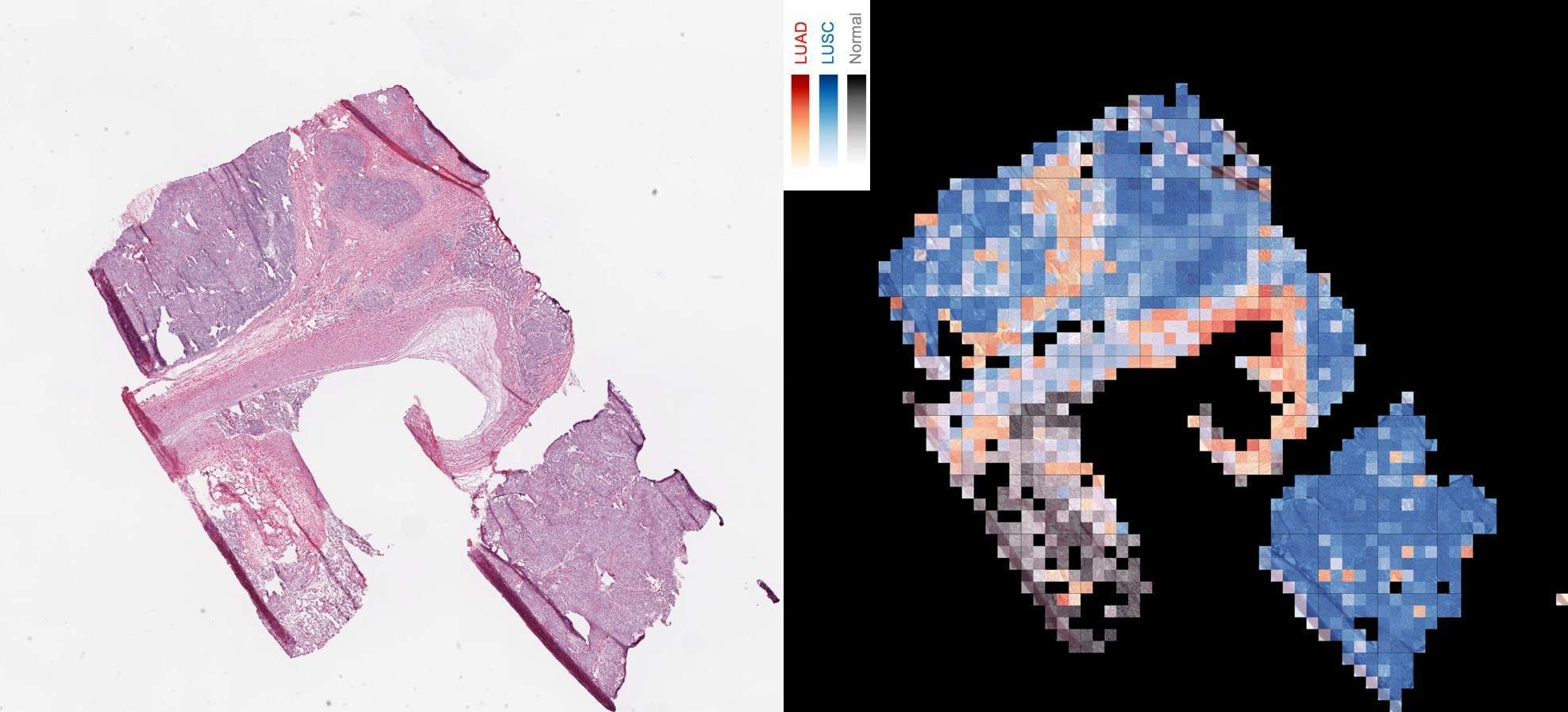 Study shows new computer program can analyze images of patients’ lung tumors