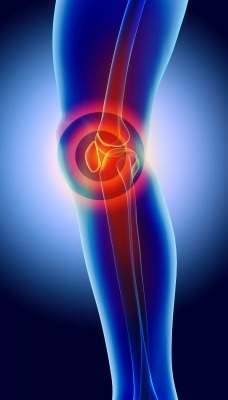 Regentis extends SAGE clinical trial of GelrinC for knee pain
