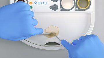 Avita Medical begins clinical study of Recell system to treat children with burn injuries