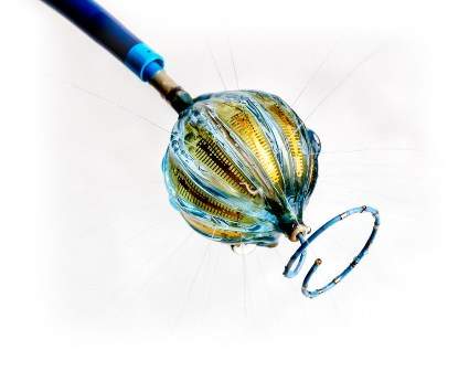 Biosense Webster begins US IDE study of Heliostar RF balloon ablation catheter