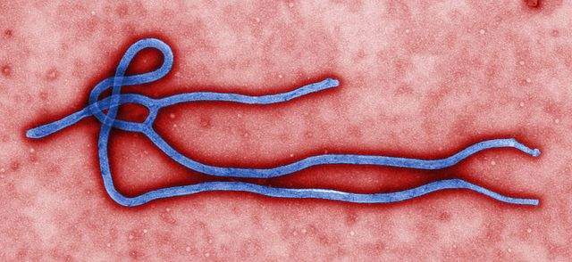 Chembio secures FDA EUA authorization for Ebola virus diagnostic test