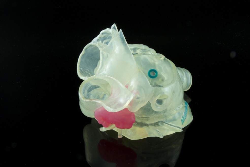 Materialise validates Stratasys 3D printers for patient-specific anatomical models