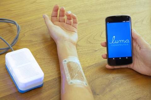 Luma Therapeutics introduces light-based therapy for plaque psoriasis