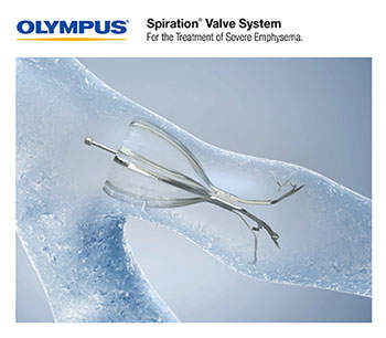 Olympus introduces Spiration valve system for treatment of severe emphysema