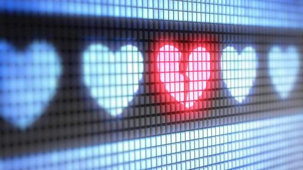 Mayo Clinic research uses AI to develop inexpensive early detector of heart disease