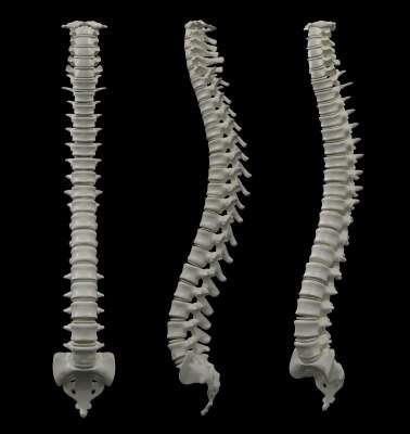 Centinel Spine announces initial cases with fourth system of FLX platform of 3D-printed all-titanium interbody devices