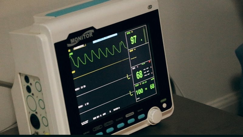 AtriCure enrolls first patient in ICE-AFIB clinical trial