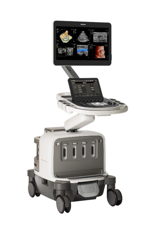 Philips launches EPIQ Elite ultrasound system for general imaging, obstetrics & gynecology