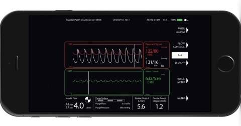 Abiomed gets CE mark for Impella Connect cloud-based monitoring platform