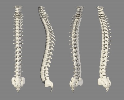 MTS helps medical device manufacturer develop 3D-printed spinal implants