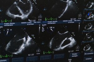 SuperSonic Imagine supplies Paris Radiology Institute with 11 Aixplorer MACH 30 ultrasound systems