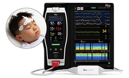 Masimo secures CE mark for next-gen SedLine pediatric brain monitor