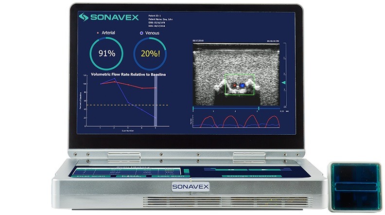 Sonavex secures FDA clearance for EchoSure