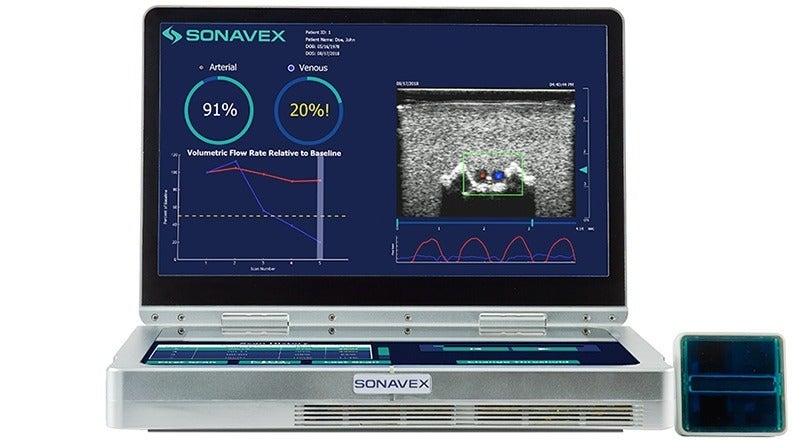 Sonavex secures FDA clearance for EchoSure