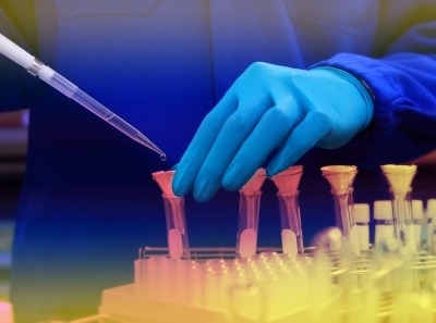 Sherlock Biosciences licenses Wyss technology to create affordable molecular diagnostics