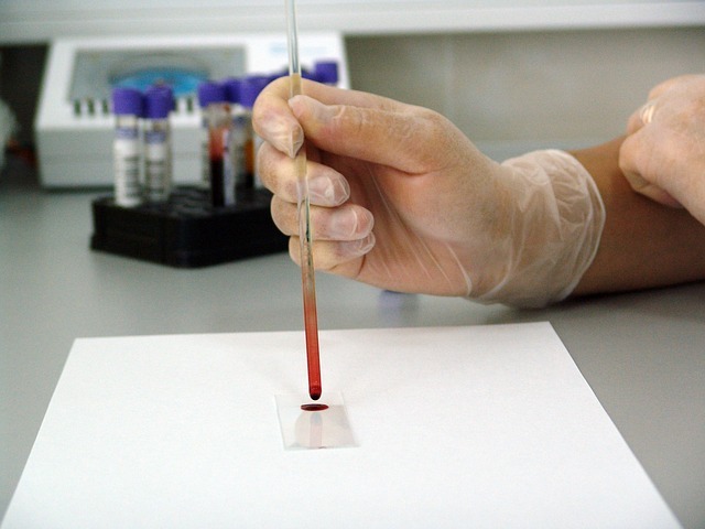 New study shows Abbott blood test can predict cardiac diseases in advance