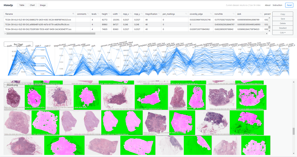 Researchers develop the first quality-control tool for digital tissue imaging