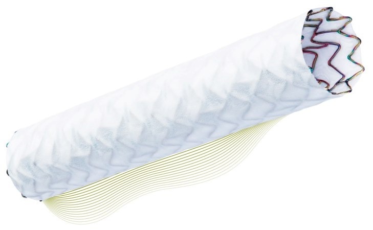 Biotronik launches PK Papyrus covered coronary stent in US