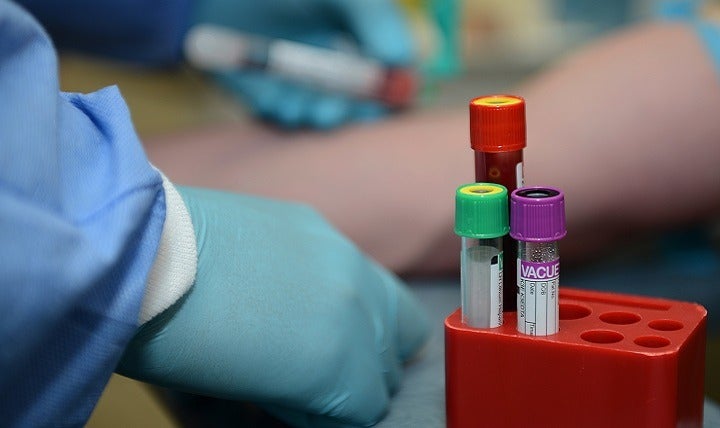 How a new blood test for prostate cancer could reduce highly invasive procedures