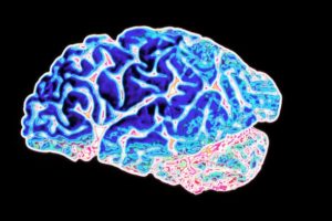 The key role of biomarkers in drug development for Alzheimer’s disease patients