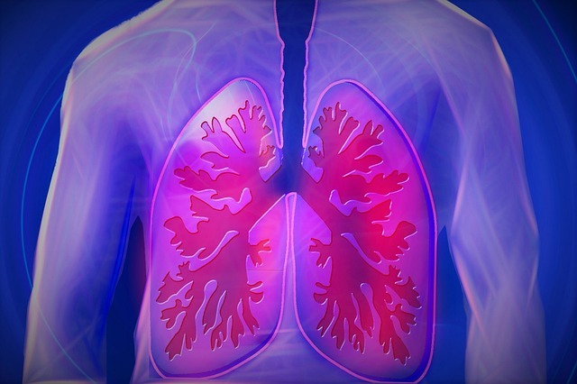 Pulmonx secures $65m in financing round led by Ally Bridge