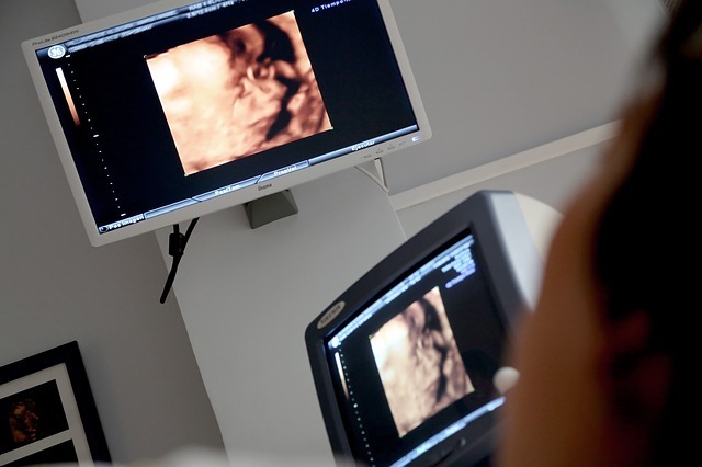 SuperSonic Imagine unveils new ultrasound system Aixplorer MACH 30