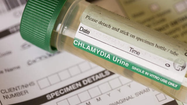 chlamydia and gonorrhea home test