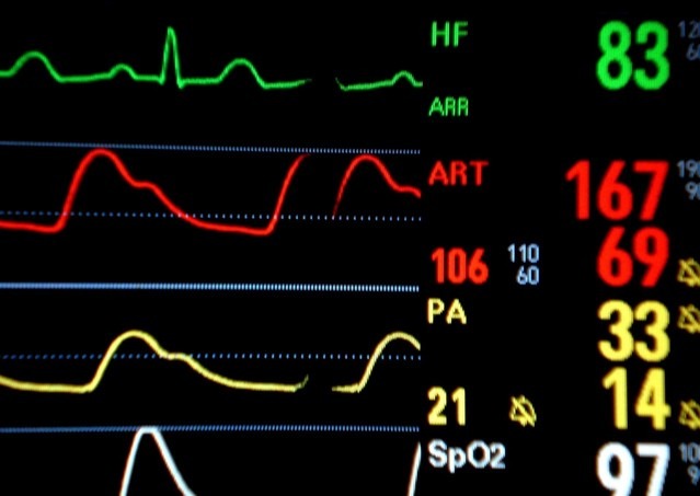 FDA clears Biofourmis’ RhythmAnalytics for AI-based interpretation of cardiac arrhythmias