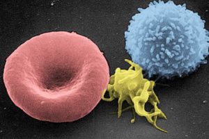 How a new microfluidic device can help doctors separate tumour cells from blood samples