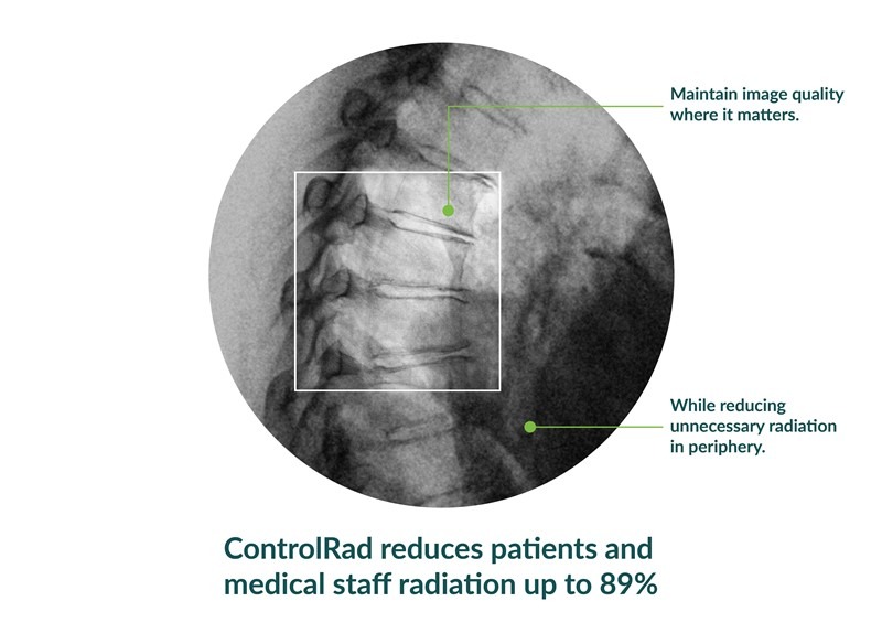ControlRad secures FDA clearance for Trace radiation reduction technology