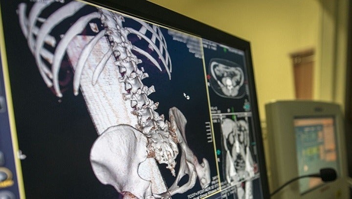 New AI-powered platform to be built for radiologists at the NHS