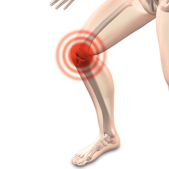CyMedica launches clinical trial to evaluate e-vive for knee osteoarthritis