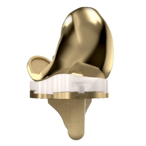 MicroPort Orthopedics announces launch of Evolution NitrX medial-pivot knee system