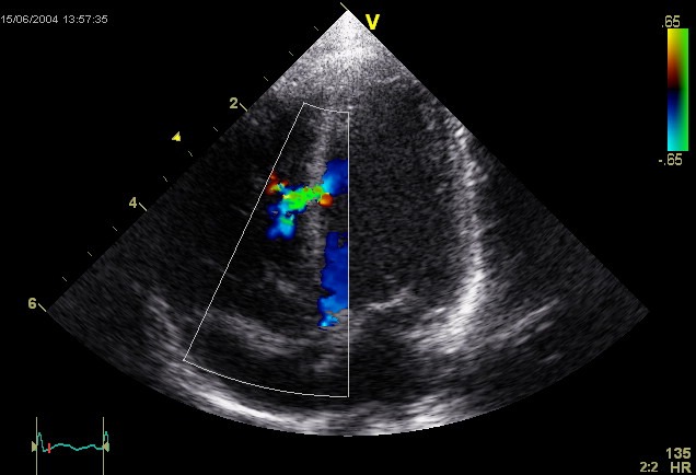 Fujifilm unveils echocardiography technology at ASE 2019
