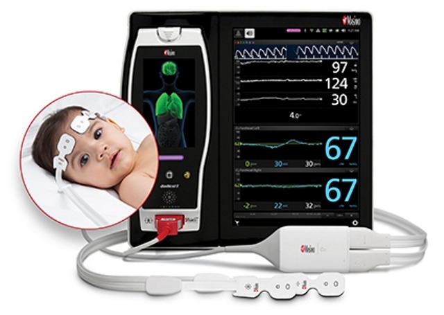 FDA approves Masimo’s O3 regional oximetry for infant patients