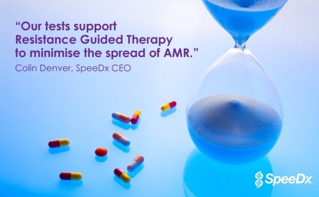 SpeeDx signs collaborative agreement with GSK to supply tests and technology