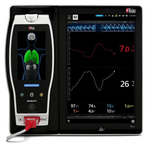 Masimo announces results of using SpHb to noninvasively monitor hemoglobin levels