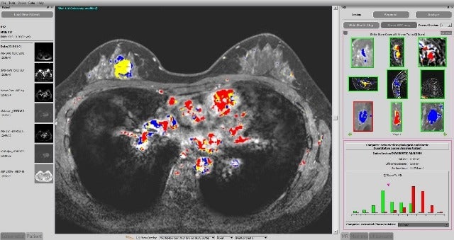 Paragon Biosciences launches new firm to expand AI-based diagnostic applications