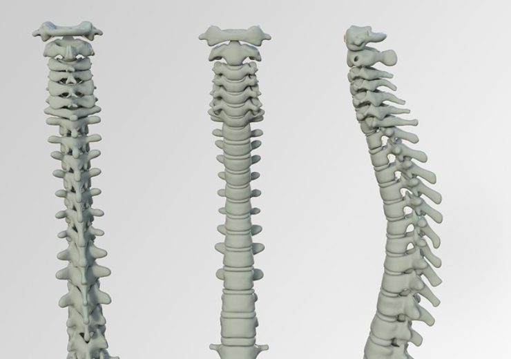 Life Spine announces FDA 510(k) clearance for PROLIFT expandable spacer system in 8mm-10mm widths