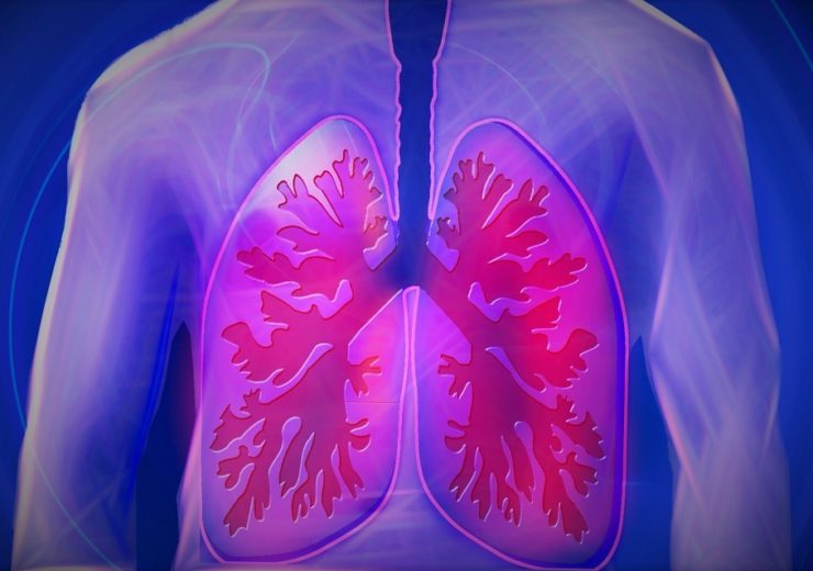 Zambon acquires Breath Therapeutics to advance inhalation therapy for BOS