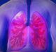 Zambon acquires Breath Therapeutics to advance inhalation therapy for BOS